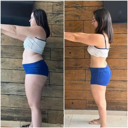 Antes e depois de Camila R., 36