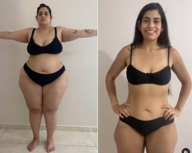 Antes e depois de Juliana P., 42