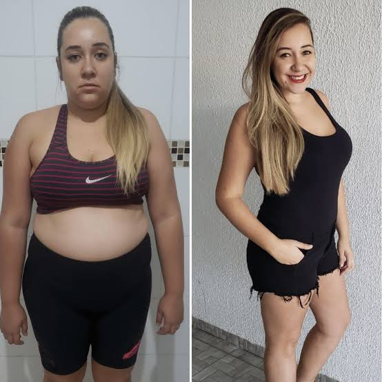 Antes e depois de Fernanda A., 45